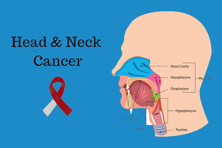 Best cancer oncologist in Delhi performing robotic surgery for throat cancer treatment