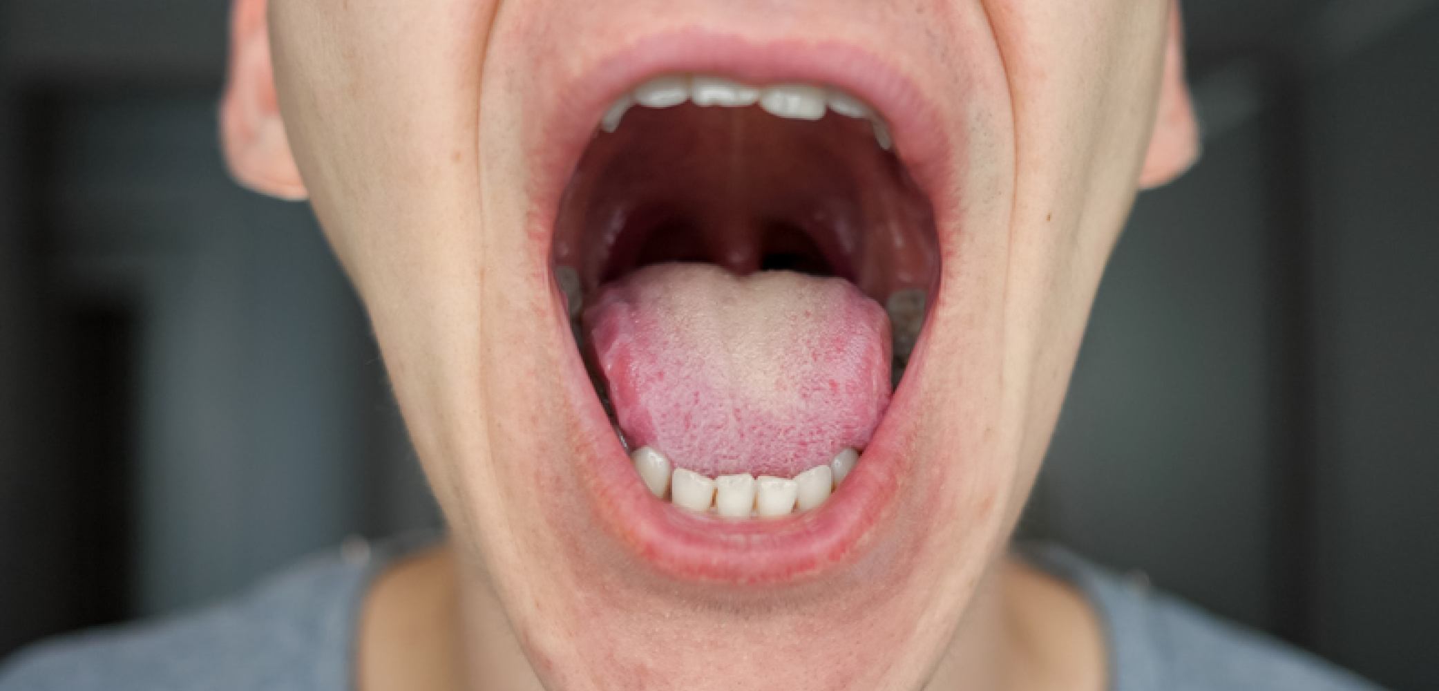 best doctor for mouth cancer in moradabad
